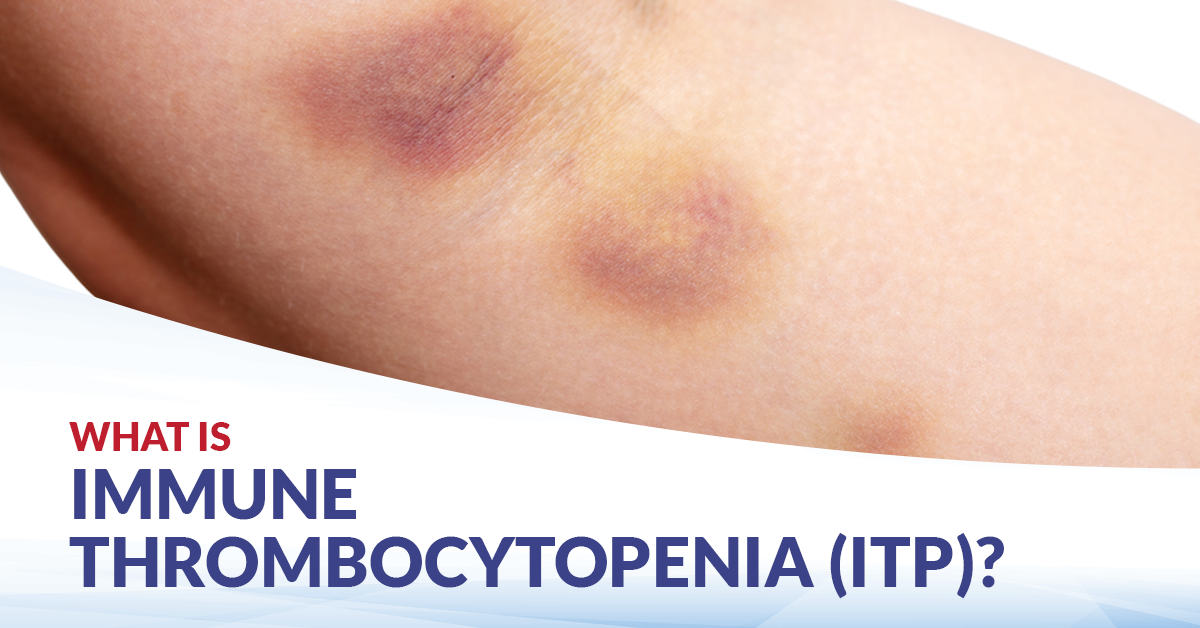 Immune Thrombocytopenia (ITP)